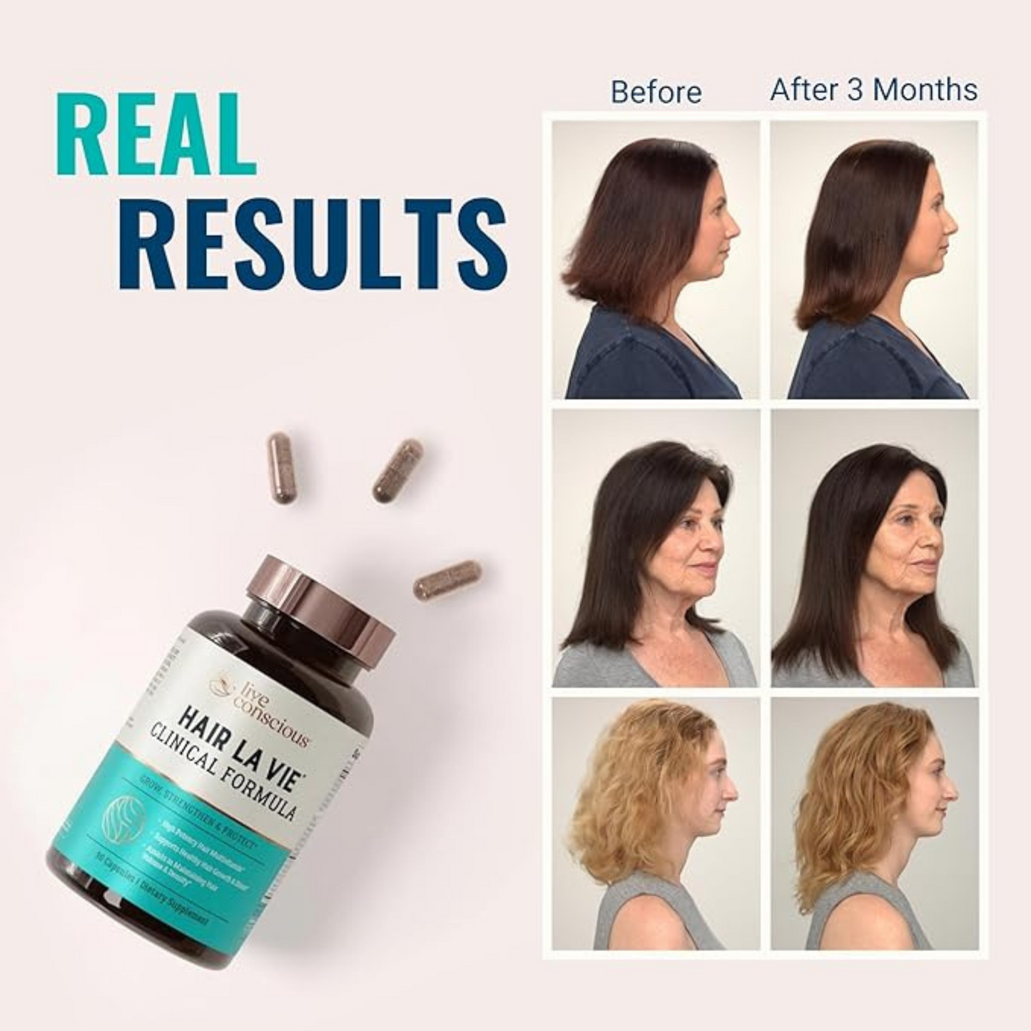 Hair La Vie Clinical+ – Advanced Hair Growth & Scalp Support Vitamins