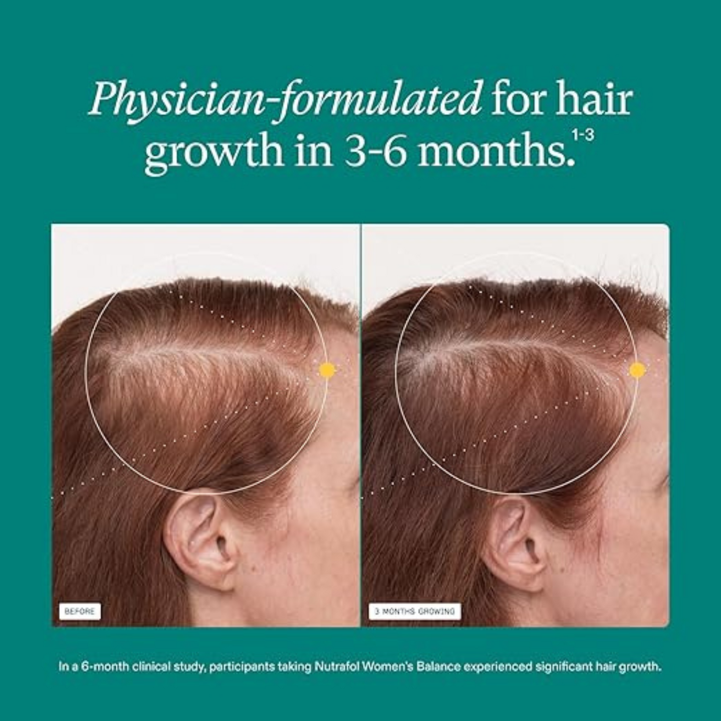 Nutrafol Harmony Hair™ – Advanced Menopausal Hair Support