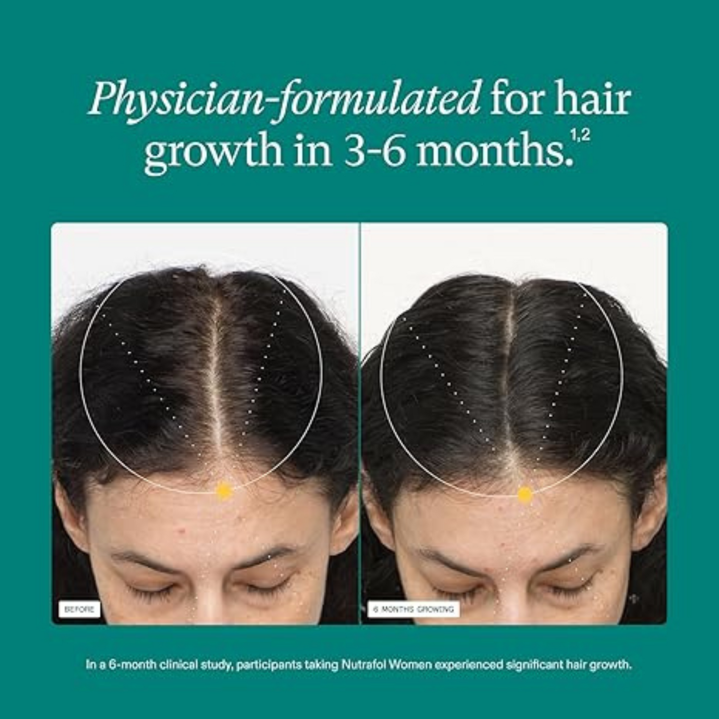 Nutrafol Radiance™ – Women’s Advanced Hair Growth Formula